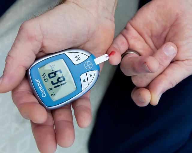 Gần 2 tỉ người có thể mắc bệnh gan chuyển hóa vào năm 2050