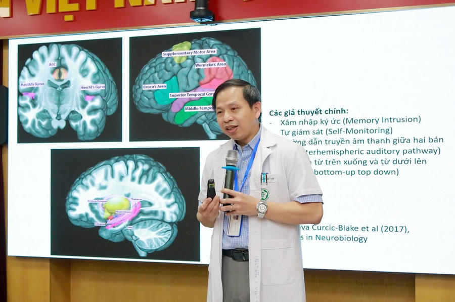 PGS.TS Nguyễn Văn Tuấn, Viện trưởng Viện Sức khoẻ tâm thần chia sẻ về cơ chế ảo thanh trong não bộ