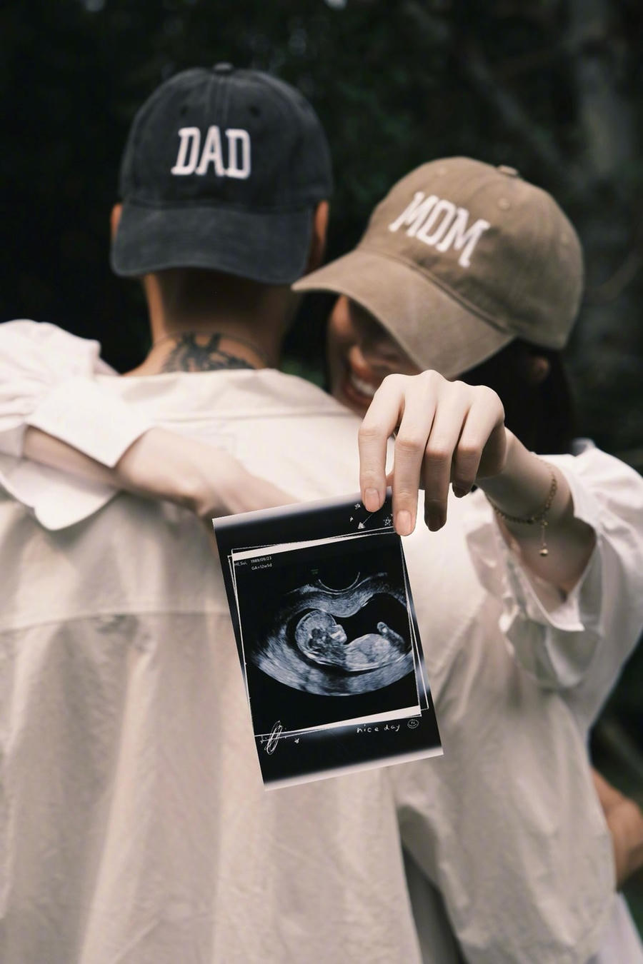 Siêu mẫu U40 công khai quá trình “độ nhan sắc” sau khi sinh con, 1 bài đăng mà lên ngay xu hướng